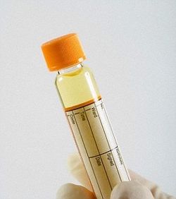 沒油請撒尿 科學家發明尿液為燃料的混合動力車